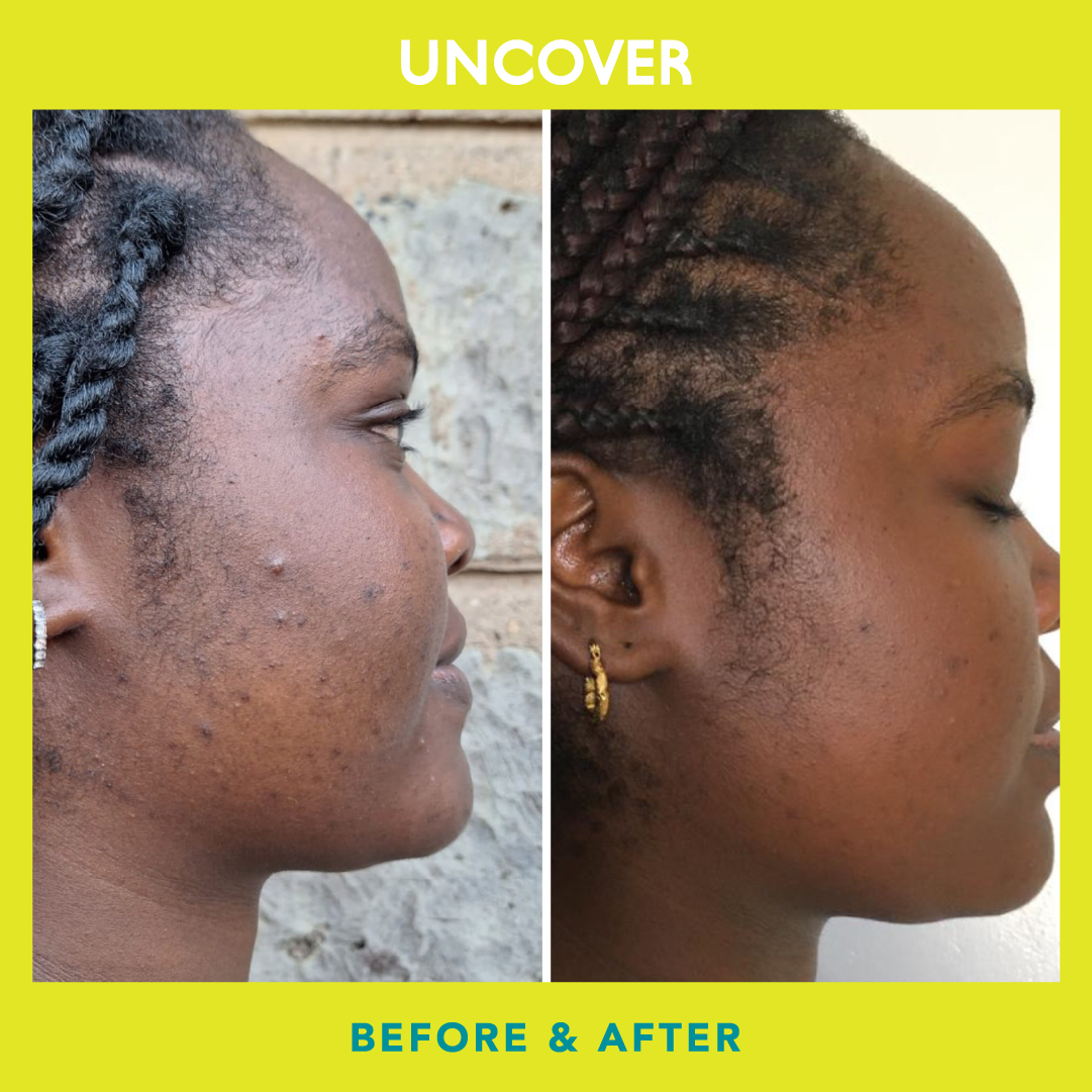 Green Tea Blemish Control Serum